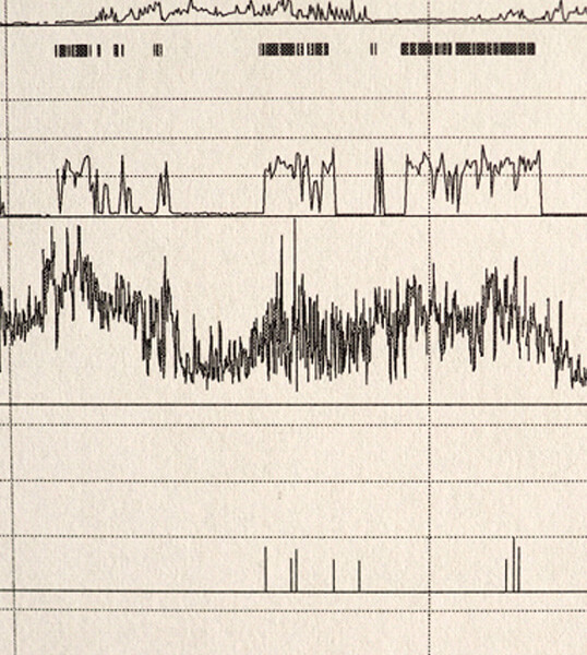 sleep apnea test data