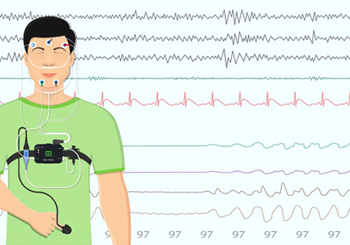 illustration of a sleep test