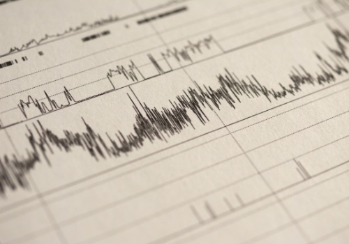 Close up of heart rate test results on a paper