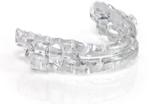 Clear oral appliance