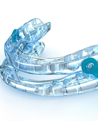 We treat sleep apnea with comfortable oral appliance therapy near Chandler.
